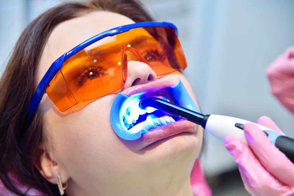 Clareamento Dental